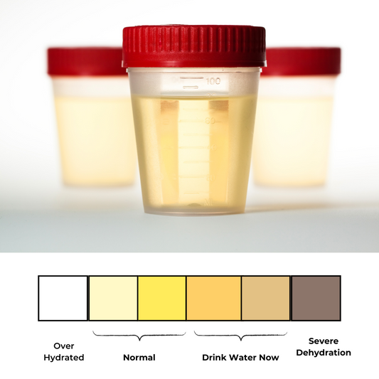 What is your Urine Color Telling you about Hydration